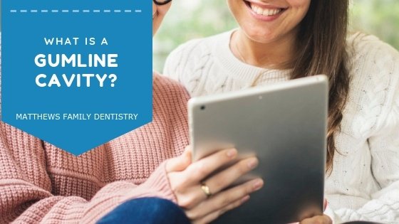 what is gumline cavity