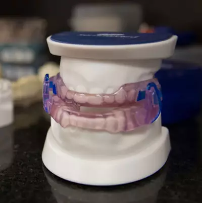 Oral-appliance