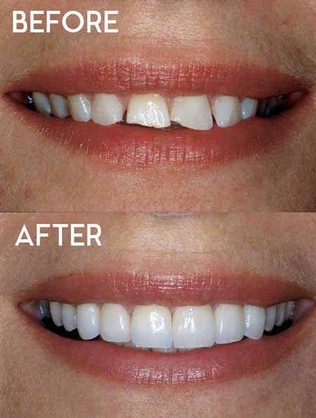 Best Cosmetic Dentistry | Cosmetic Dentistry Matthews NC