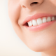 what is a smile makeover