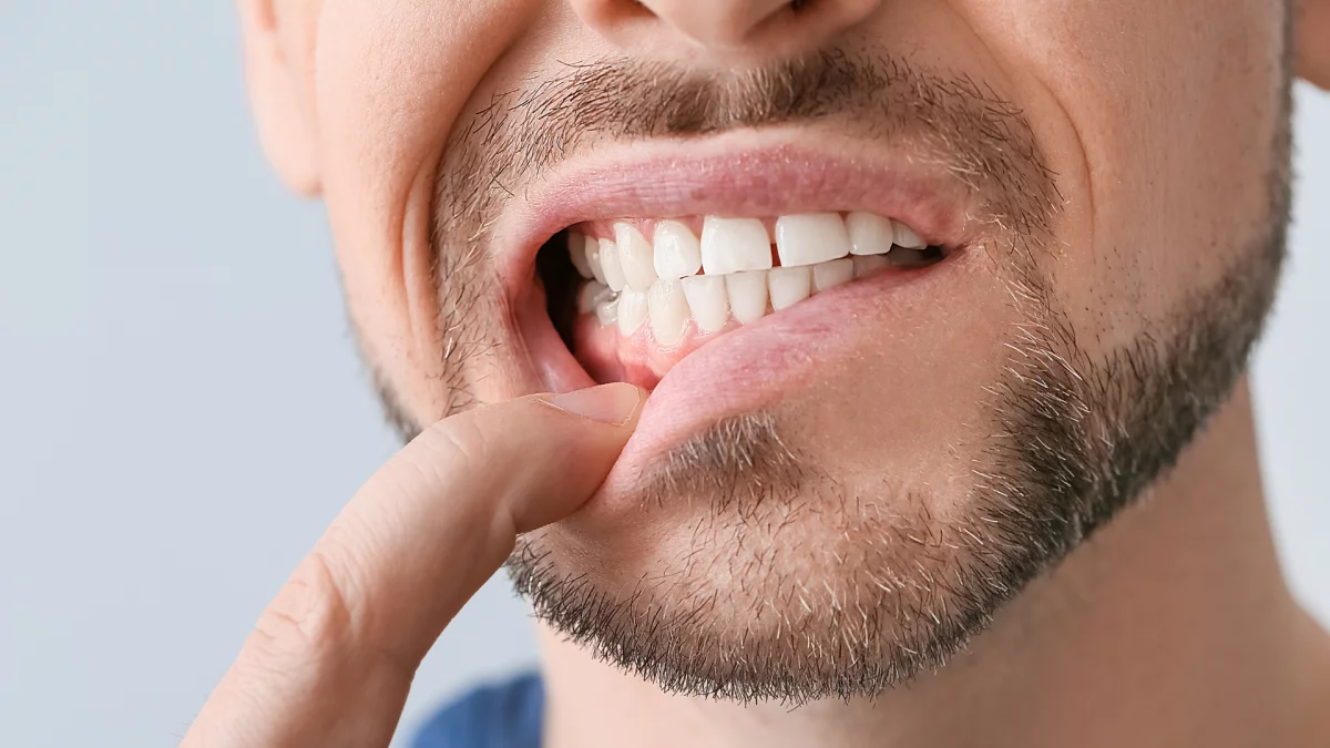 how to treat tooth decay at the gum line