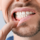 how to treat tooth decay at the gum line