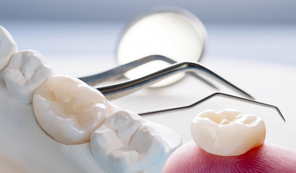 dental crown
