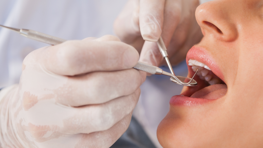 Tips For Perfect Dental Health