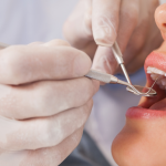 what is restorative dentistry